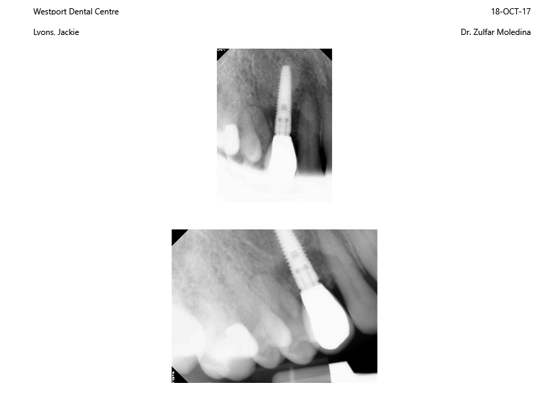 Westport Dental Centre | 41b Main St, Westport, ON K0G 1X0, Canada | Phone: (613) 273-2727