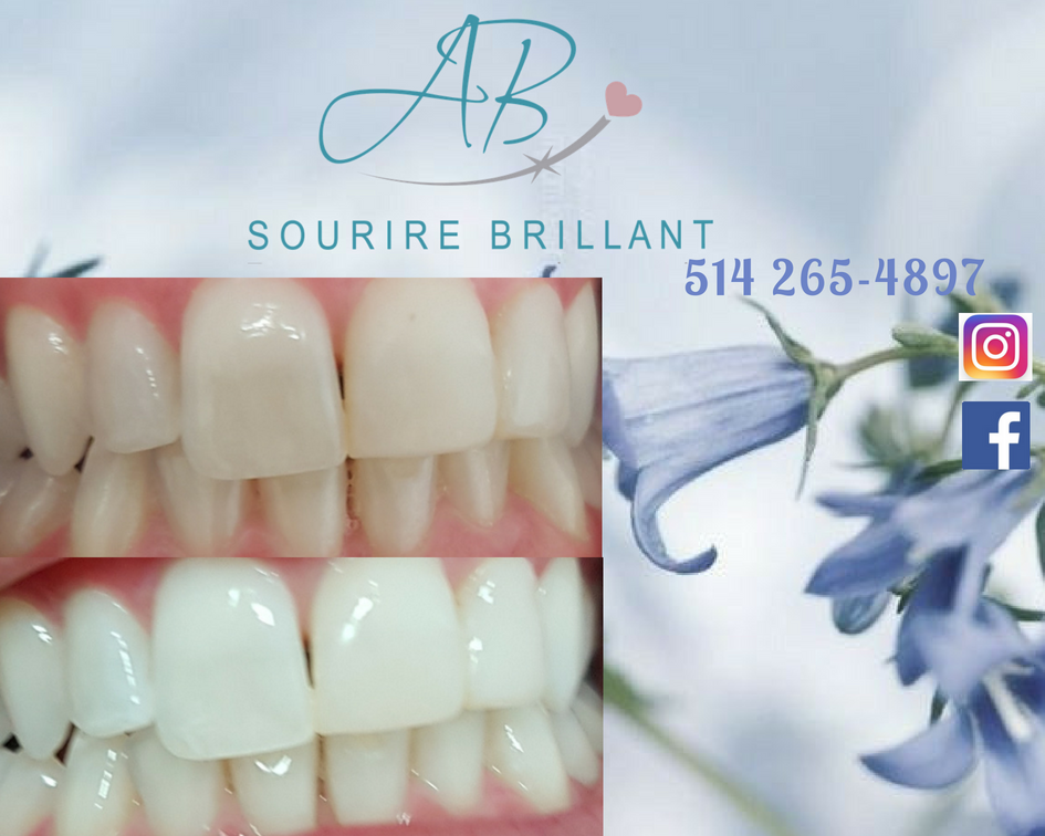A.B. Sourire Brillant | 4600 Boulevard Sainte-Rose, Laval, QC H7R 1Z2, Canada | Phone: (514) 265-4897