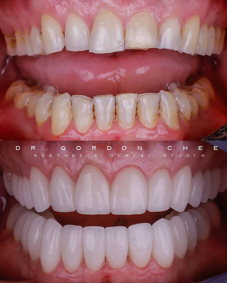 Aesthetic Dental Studio | 5005 Dalhousie Dr NW #275, Calgary, AB T3A 5R8, Canada | Phone: (403) 543-4600