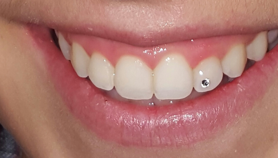 Sparkle Dental Hygiene Services | 5731 Old Highway 2 Unit #2, Shannonville, ON K0K 3A0, Canada | Phone: (613) 827-0504
