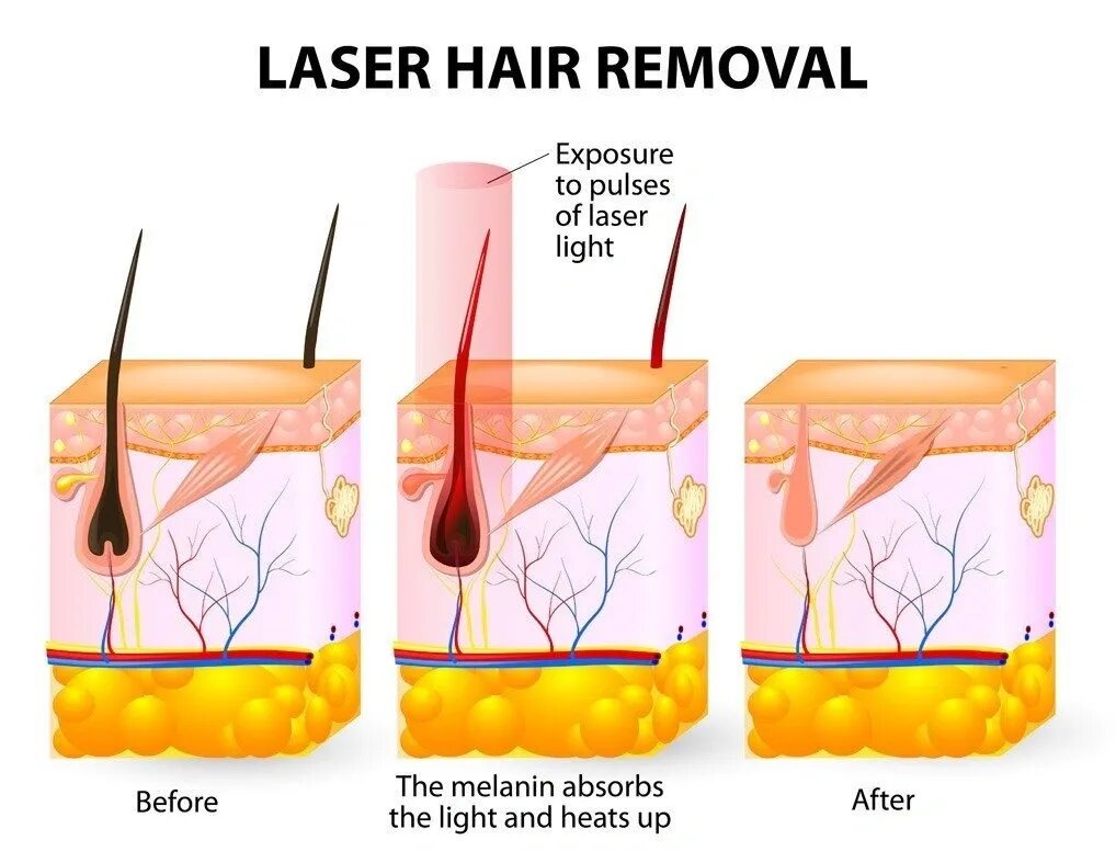 Bare Medical Aesthetics | 350 Ridout St S, London, ON N6C 3Z5, Canada | Phone: (519) 601-3900