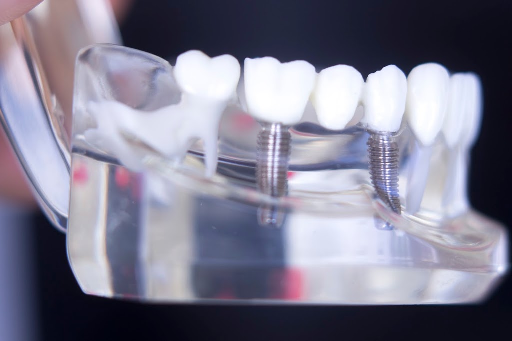 Compleo at Dentistry At Vitality Health | East, 4792 Hwy 7, Unionville, ON L3R 1M8, Canada | Phone: (647) 993-4792