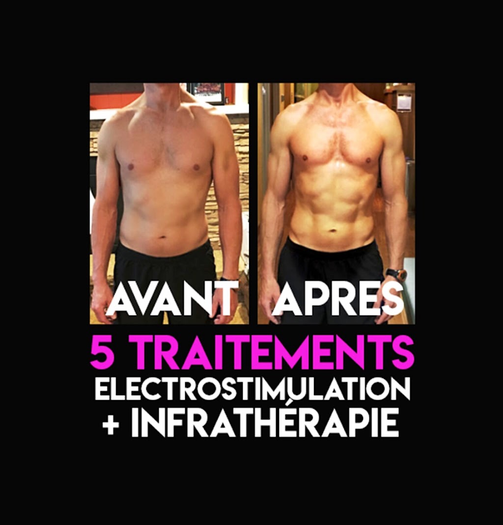 Electrostimulation rive-sud | 87-d Rue St Pierre, Saint-Constant, QC J5A 1G7, Canada | Phone: (514) 730-8423