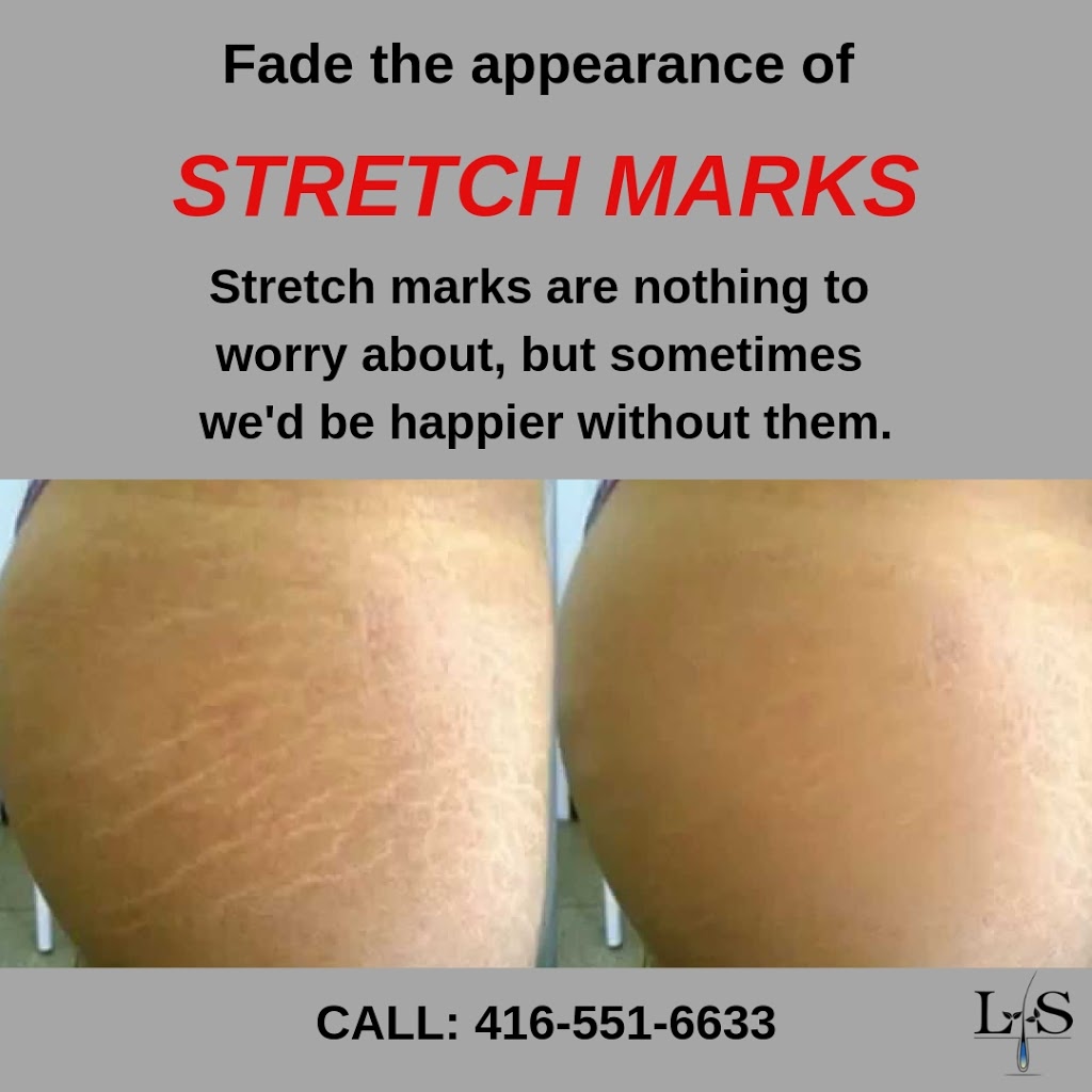 Laser Clinic and Spa | 35 Winchester Rd E, Whitby, ON L1M 1B4, Canada | Phone: (647) 922-9308