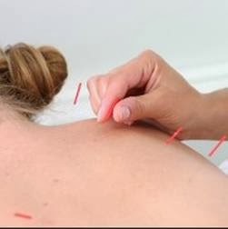 South Buffalo Chiropractic - Dr. Frank Tang | 1923 Seneca St, Buffalo, NY 14210, USA | Phone: (716) 688-8815