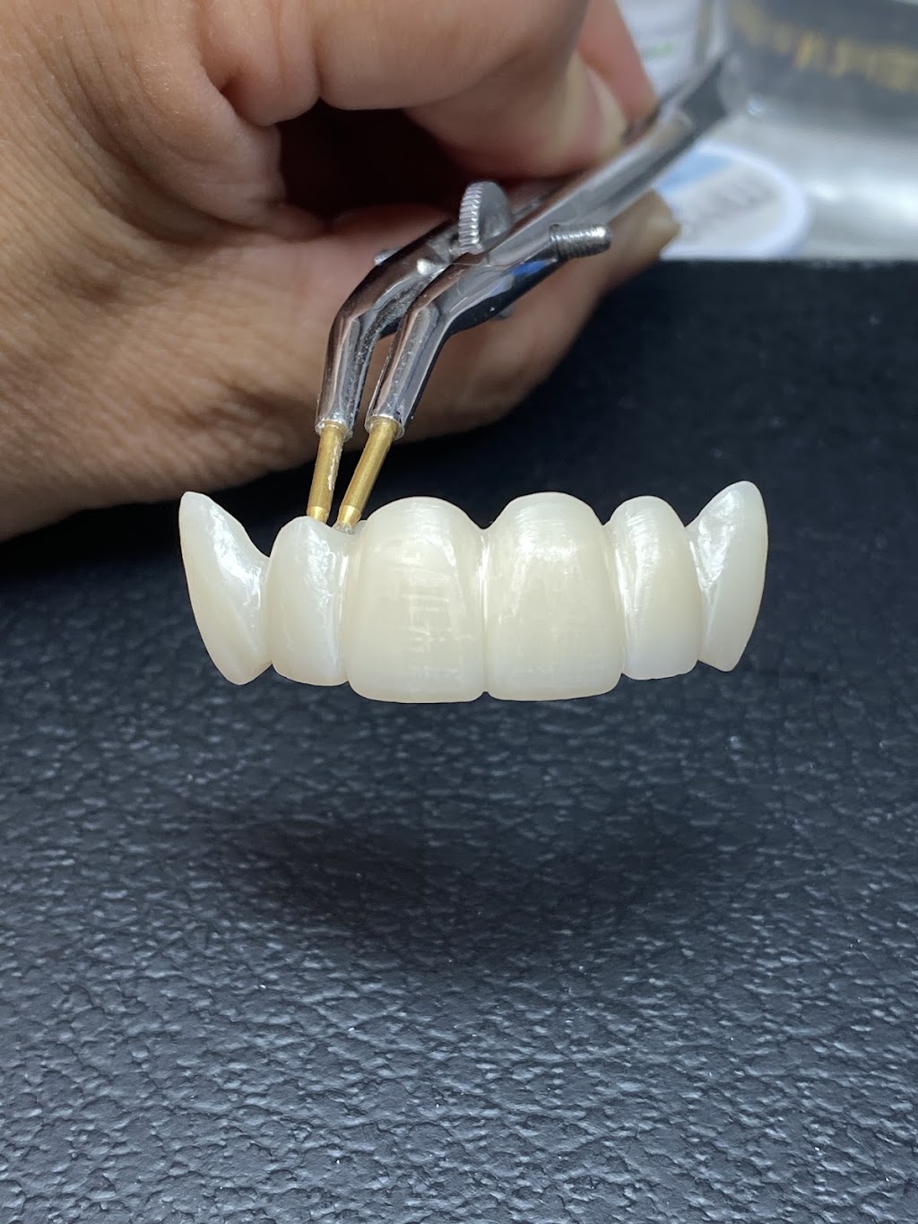 Labworks Dental Services | 10160 Ainsworth Crescent, Richmond, BC V7A 3V4, Canada | Phone: (604) 916-1875