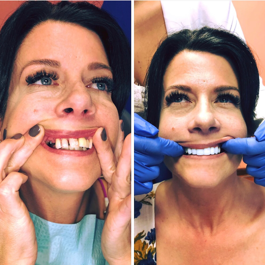 Bellwether Dental Implants & Oral Surgery | 12 Bellwether Way Ste 114, Bellingham, WA 98225, USA | Phone: (360) 366-8026