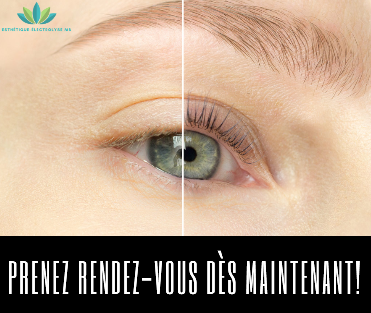 Esthétique-Électrolyse MB | 420 2e Avenue, Saint-Jean-sur-Richelieu, QC J2X 2A1, Canada | Phone: (514) 358-9611