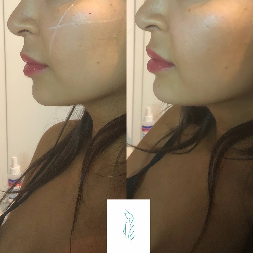 Let Them Notice - Botox Clinic Toronto/Etobicoke | 170 North Queen Street K, Unit 20, Toronto, ON M9C 1A8, Canada | Phone: (416) 904-6653