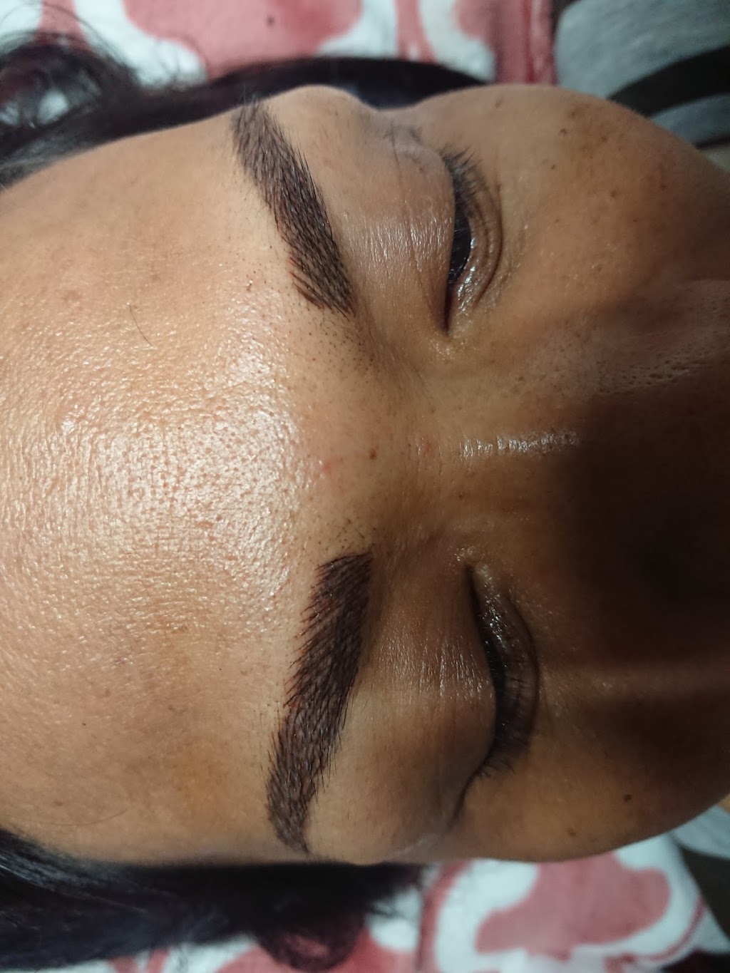 JudithAesthetica | 2401Ambkecote, Burlington, ON L7P 4E6, Canada | Phone: (905) 484-3317