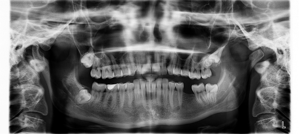 Mourad Brouri, d.d - Denturologiste - Vimont | 1686 Boulevard des Laurentides #102, Vimont, QC H7M 2P4, Canada | Phone: (450) 663-7765