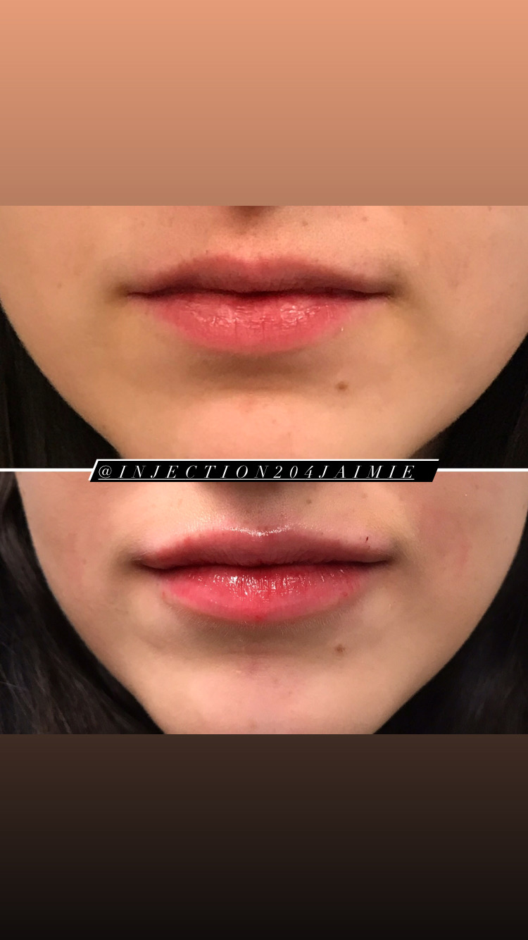 Injection204jaimie | 160 Provencher Blvd #101, Winnipeg, MB R2H 0G3, Canada | Phone: (204) 925-9779