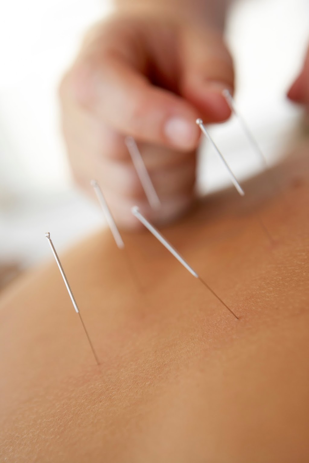 Yong Sheng Clinic - East | 2957 Kingsway, Vancouver, BC V5R 5J4, Canada | Phone: (604) 439-0865