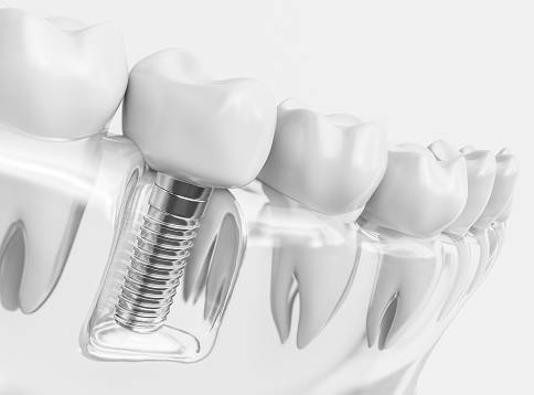 Denturos dici Carolyne Bouchard Denturologiste | 1015 Bd Olivier Vien, Roberval, QC G8H 3N9, Canada | Phone: (418) 275-3535