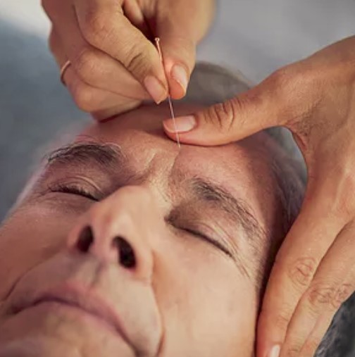 Registered Acupuncture and Massage Therapy | 1136 Aldersbrook Rd, London, ON N6G 2X8, Canada | Phone: (519) 601-5436