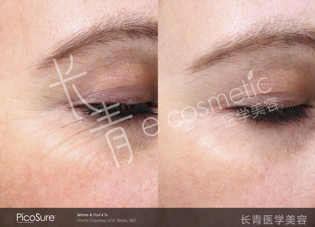 长青医学美容 - Evergreen Cosmetic | 500 Royal Oak Dr NW #216, Calgary, AB T3G 5J7, Canada | Phone: (403) 680-9960