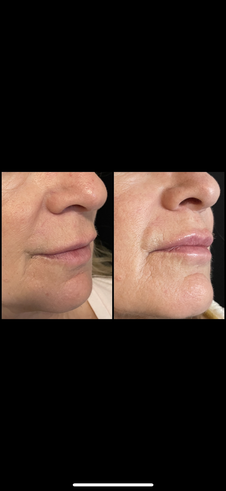 Alis Skin + Laser | 491 Wt Hill Blvd S #60, Lethbridge, AB T1J 1Y6, Canada | Phone: (403) 381-8295
