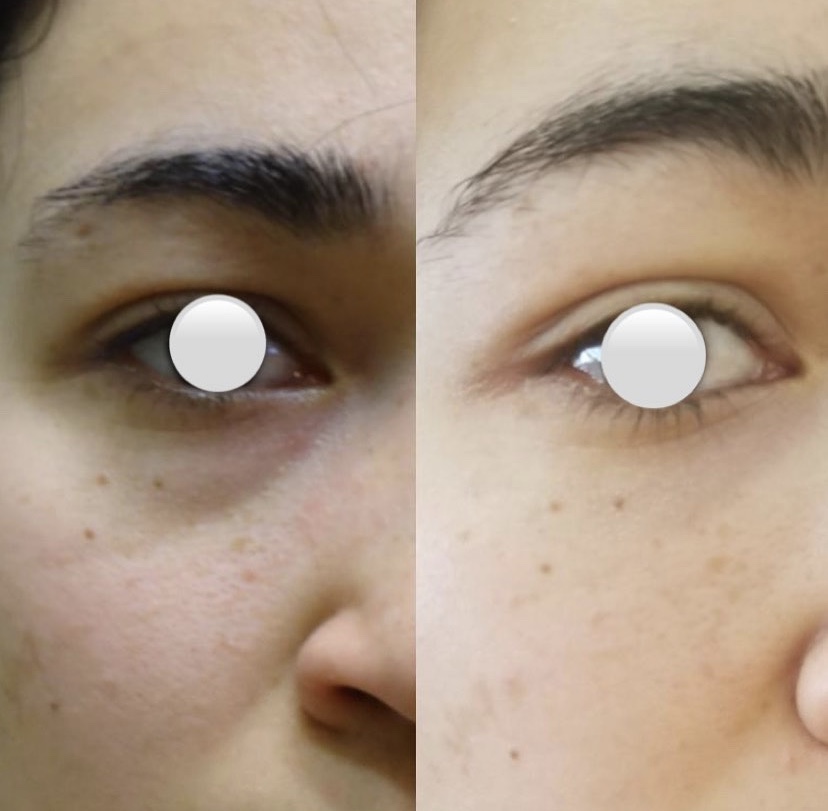 Luxe Beauté Clinic Canada - Cosmetic Dermatology | 875 Bank St, Ottawa, ON K1S 3W4, Canada | Phone: (613) 793-8987