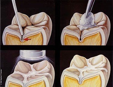 Simcoe Muskoka Dental Hygiene | 67 Red Oak Dr #101, Barrie, ON L4N 9M5, Canada | Phone: (705) 321-1871