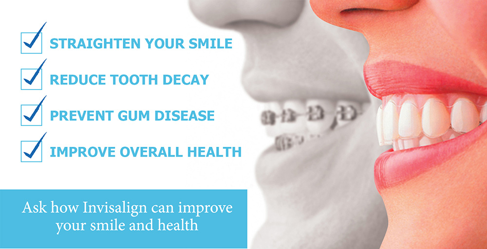 Family Dental - Dr. Khattab & Associates | 2916 Sheppard Ave E, Scarborough, ON M1T 3J4, Canada | Phone: (647) 347-2227