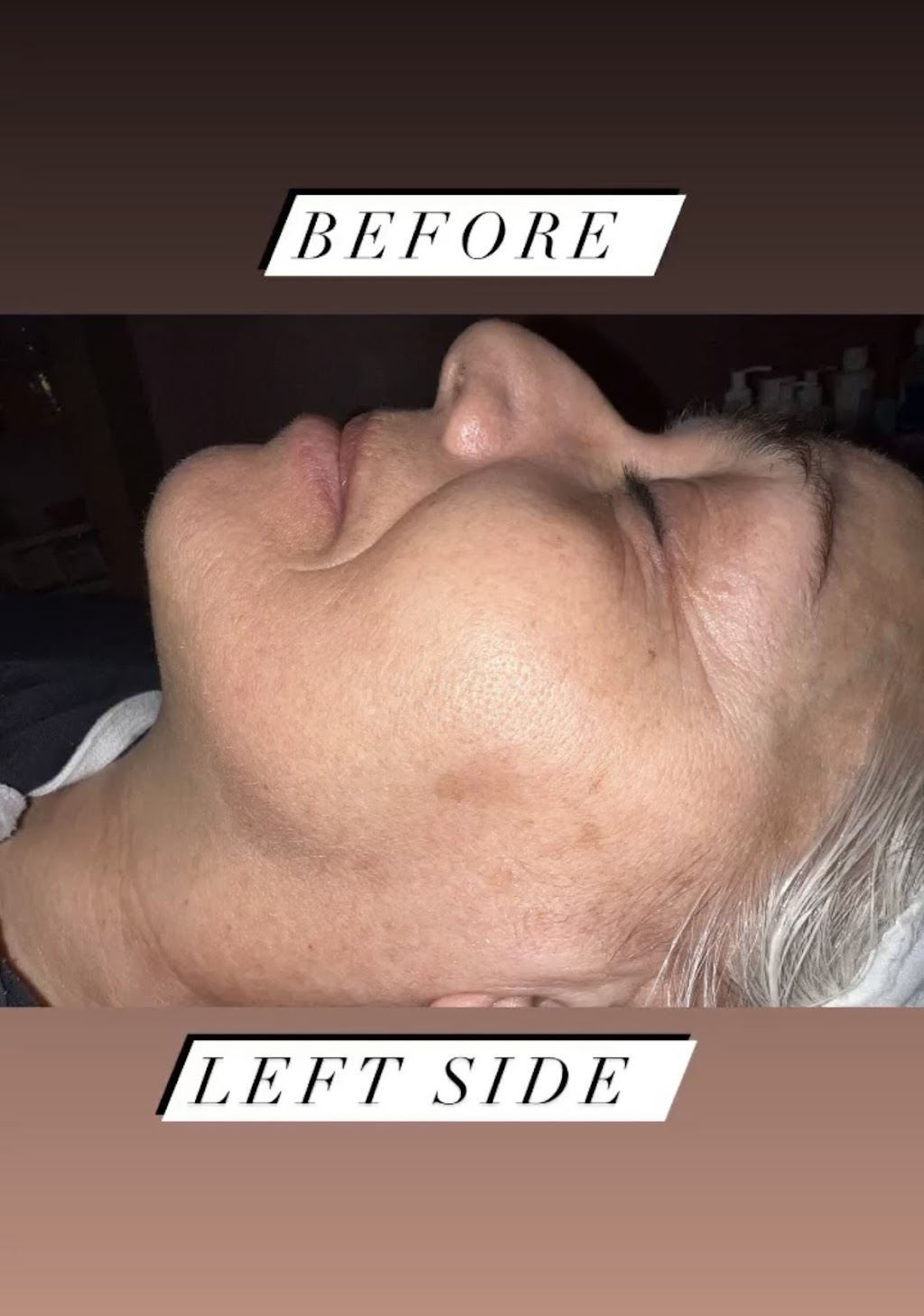 Lunar Aesthetics | Edmunds Crescent, London, ON N5Z 4J1, Canada | Phone: (519) 494-2684