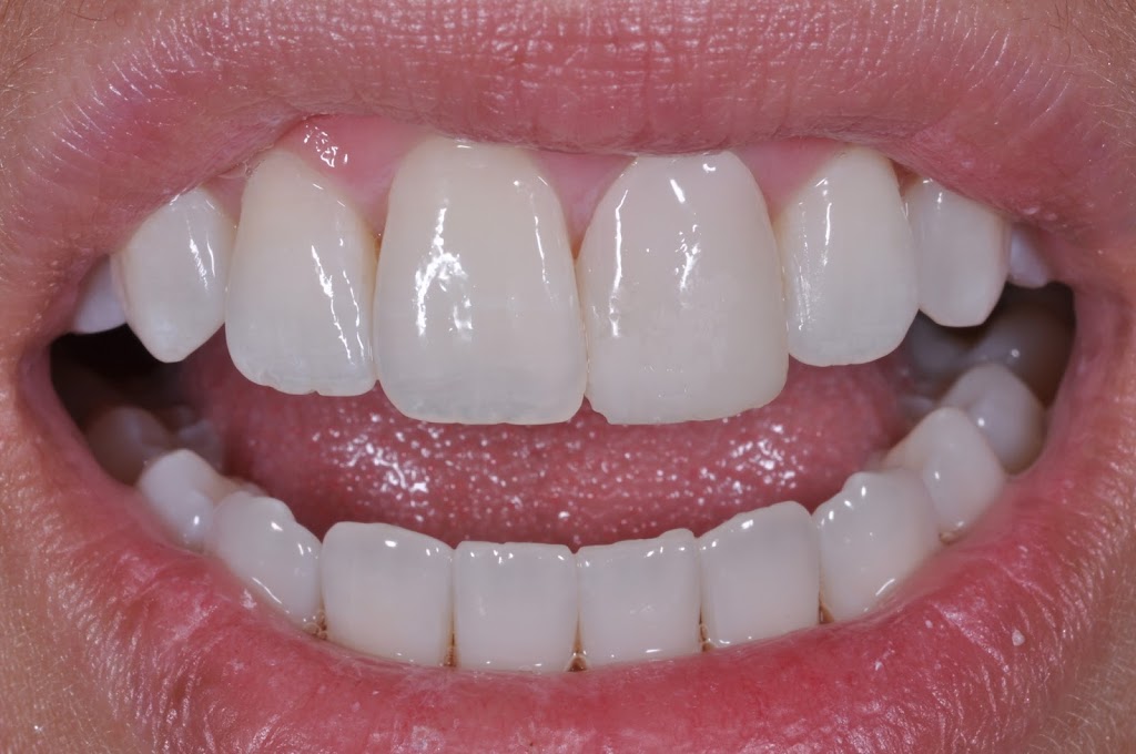 Cad Crowns Ca Inc | 210-1580 Merivale Rd, Nepean, ON K2G 4B5, Canada | Phone: (613) 723-7300