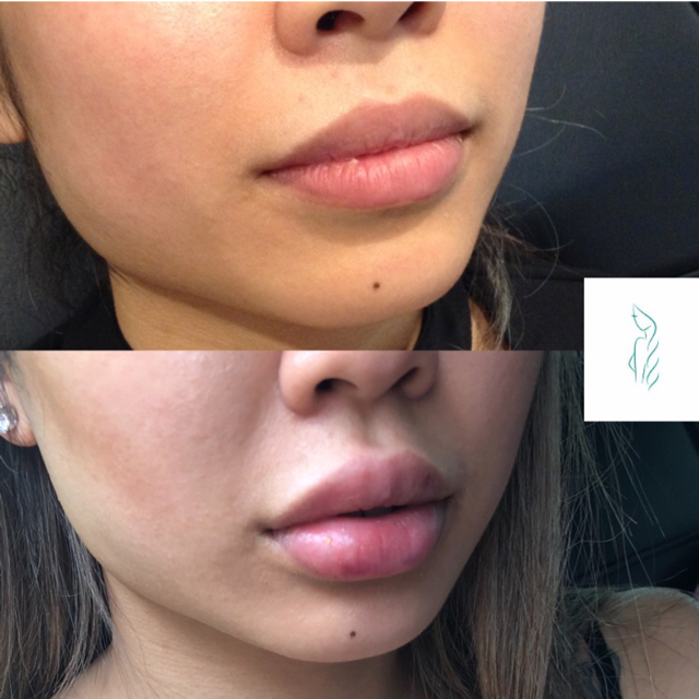 Let Them Notice - Botox Clinic Toronto/Etobicoke | 170 North Queen Street K, Unit 20, Toronto, ON M9C 1A8, Canada | Phone: (416) 904-6653