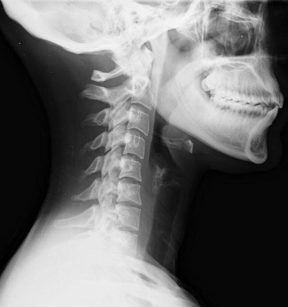 Life Chiropractic Centre | 8-2501 Guelph Line North, Burlington, ON L7M 2A3, Canada | Phone: (905) 335-5433
