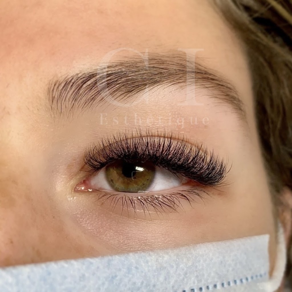 Clinique Esthétique Chloé Ippersiel | 881 Bd Gilles Villeneuve, Berthierville, QC J0K 1A0, Canada | Phone: (450) 916-2475