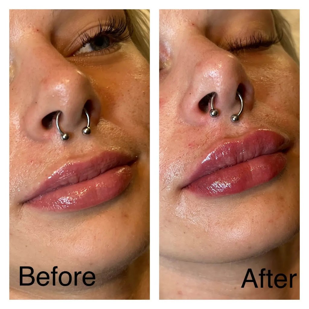 NuSkin Cosmetic Laser Clinic | Call for locations near you, 9991 Hwy 7, Kawartha Lakes, ON K9H 0A1, Canada | Phone: (705) 991-4767