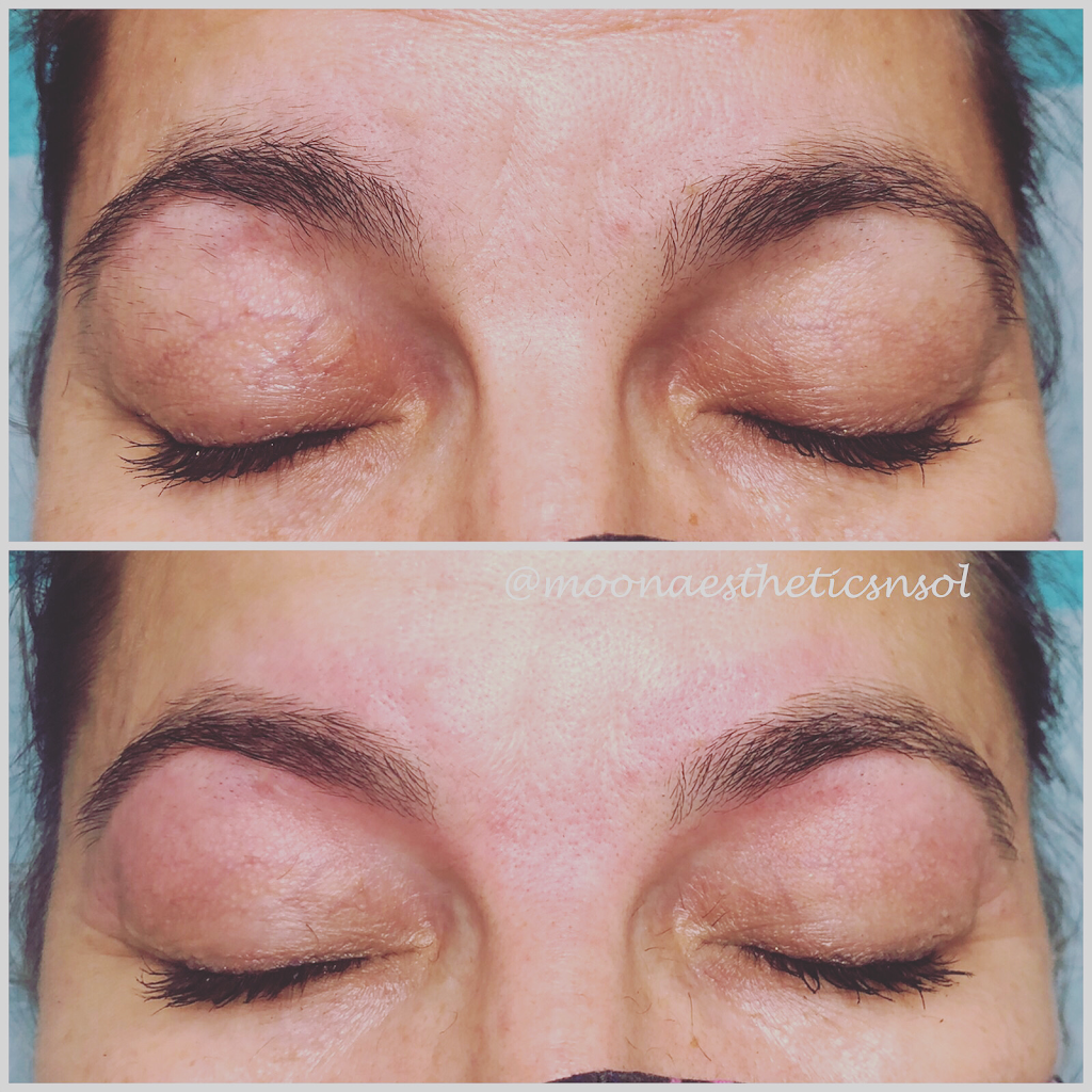 Moon Aesthetics n Solutions | 159 Shephard Ave, Alliston, ON L9R 0J8, Canada | Phone: (705) 718-1836