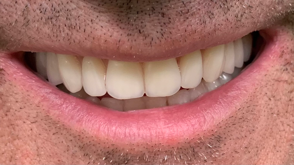 Alberta Dentures | 83 Deerpoint Rd SE #204, Calgary, AB T2J 6W5, Canada | Phone: (587) 966-3368
