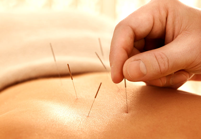 Reform Pelvic Health Physiotherapy and Rehab Clinic | 215 Delta Park Blvd #8, Brampton, ON L6T 0H9, Canada | Phone: (905) 792-8181