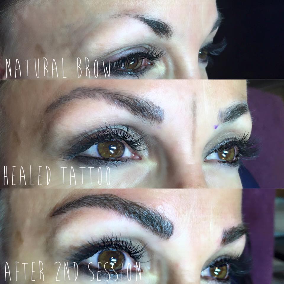 Off The Hook Laser and Spa | 30 Green Grove Dr, St. Albert, AB T8N 5H6, Canada | Phone: (780) 418-2003
