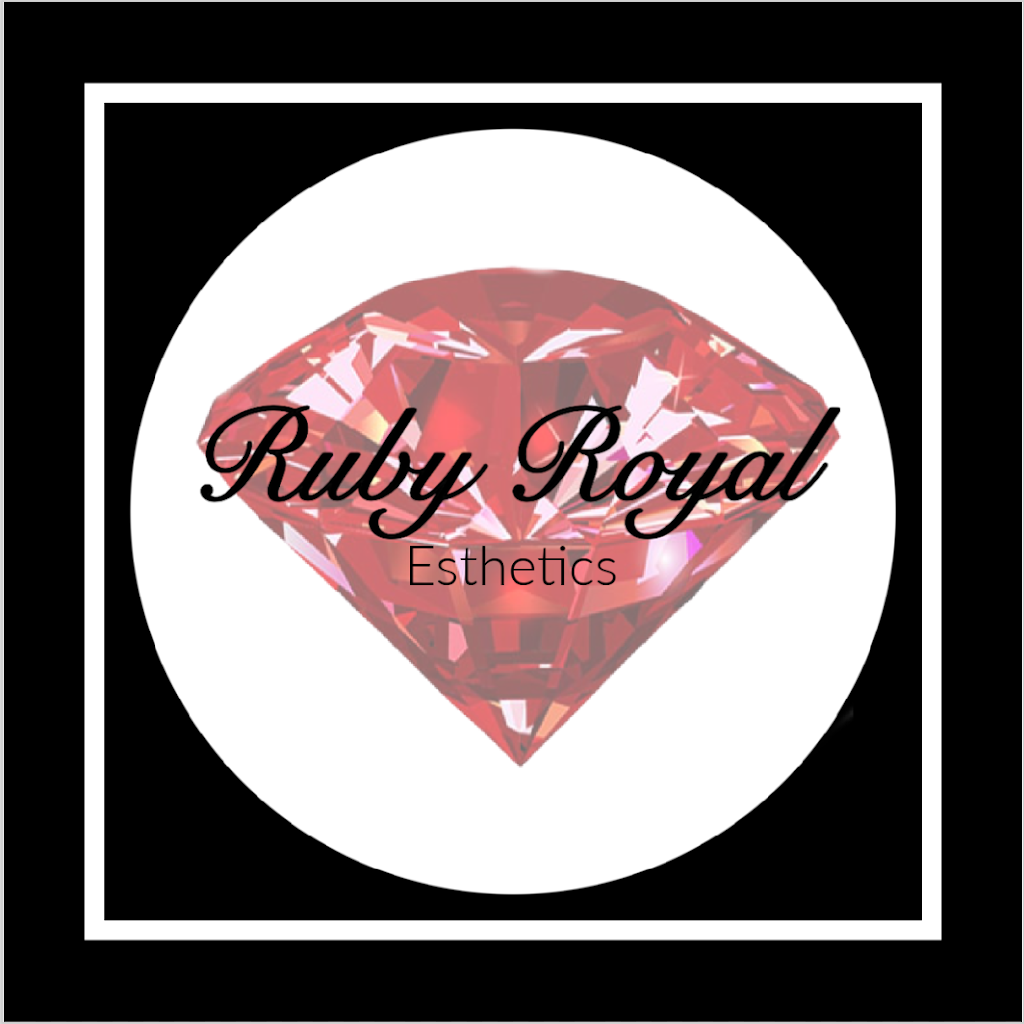 Ruby Royal Esthetics | 2315 Rue de Prague, Laval, QC H7K 3V8, Canada | Phone: (514) 245-4765