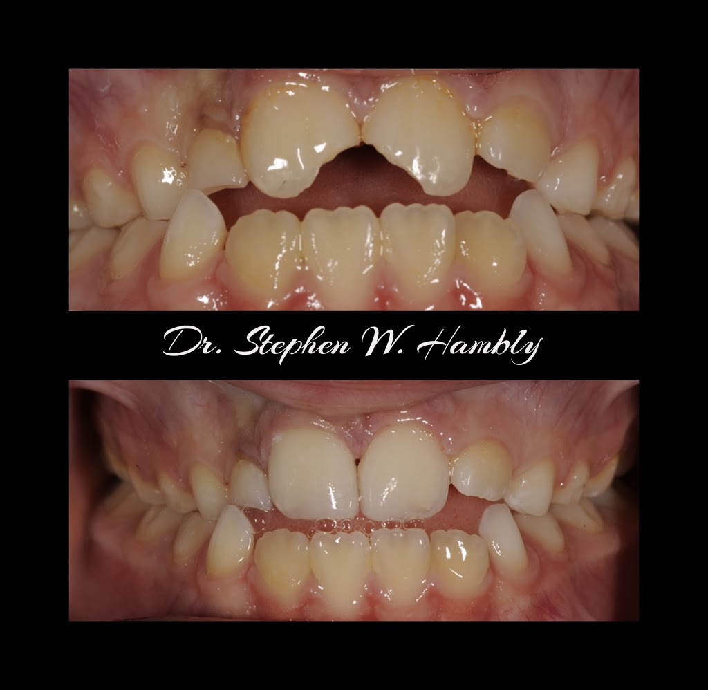 Ancaster Dental Care | 34 Stone Church Rd Suite 202, Ancaster, ON L9K 1S5, Canada | Phone: (905) 304-3479