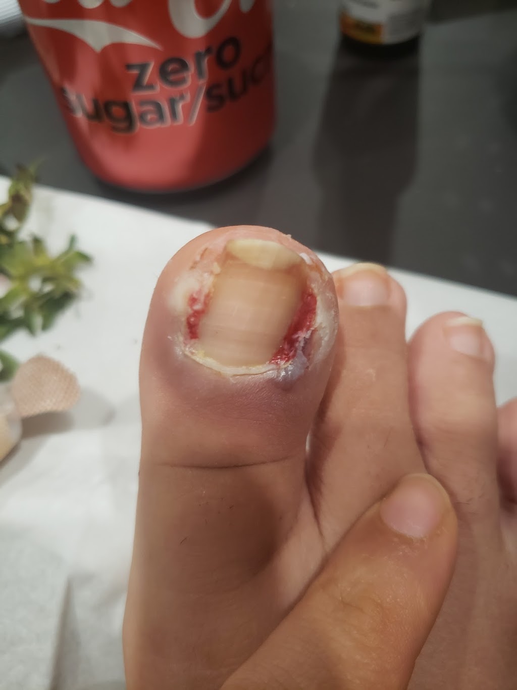 Aurora Foot and Ankle Clinic | 8880 202 St. Unit #4, Langley, BC V1M 4E7, Canada | Phone: (604) 248-8985
