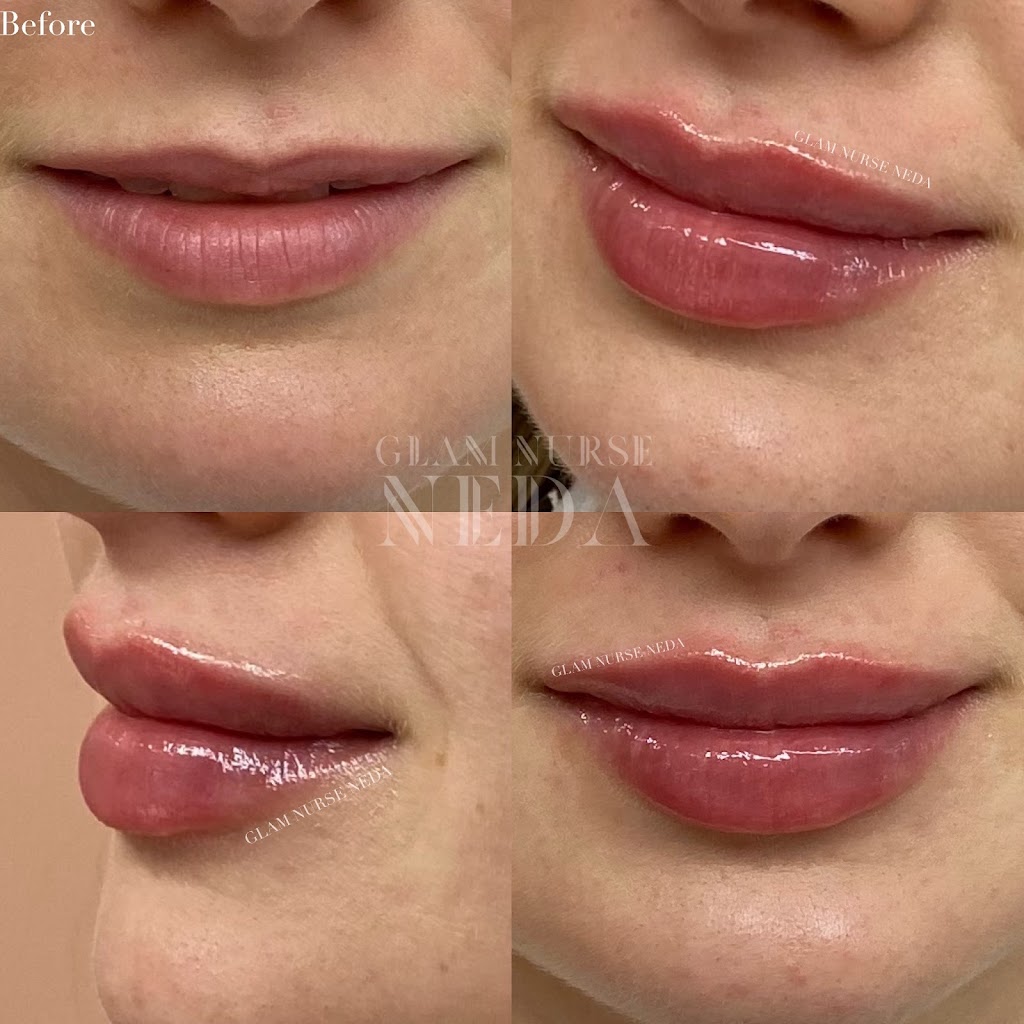 Bespoke Medical Aesthetics | 446 Winston Rd, Grimsby, ON L3M 0H2, Canada | Phone: (289) 442-1419