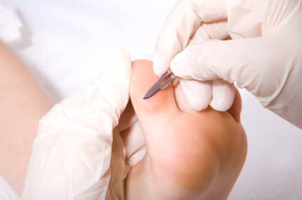 Tout en marchant Audrey Marchand infirmières en soins des pieds | 317 Rue Racine, Granby, QC J2G 3B6, Canada | Phone: (450) 405-3712