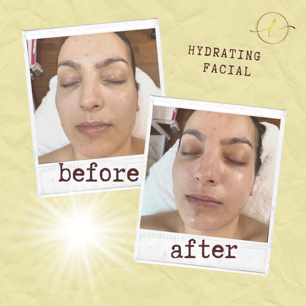Luminate Derm Spa | 130 Bainbridge Crescent NW, Edmonton, AB T5T 6B4, Canada | Phone: (780) 266-8449