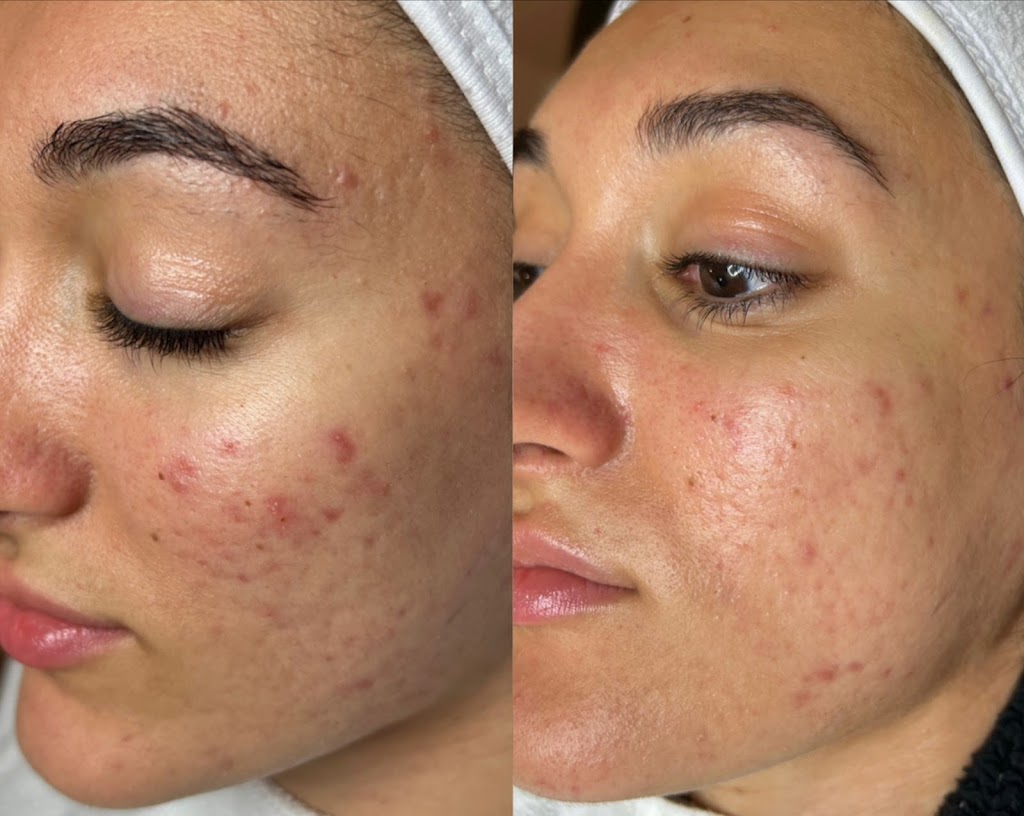 ah esthetics | 1002 King St E, Hamilton, ON L8M 1C8, Canada | Phone: (519) 771-8088