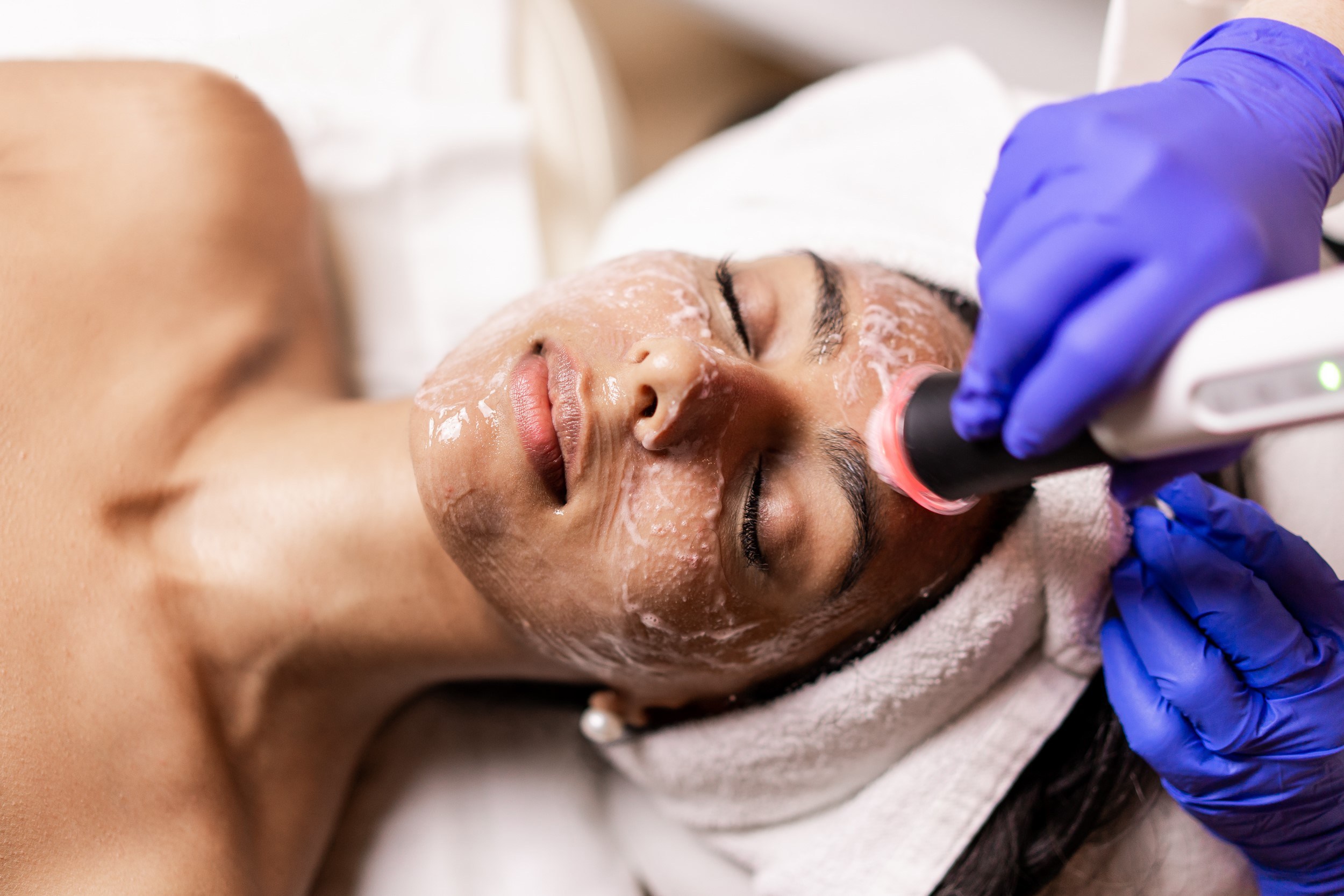 OVO Medi Spa | 4546 W 10th Ave, Vancouver, BC V6R 2J1, Canada | Phone: (604) 568-8800