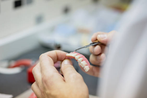 Francois Pepin d.d. denturologiste Montréal-Nord | 5900 Bd Léger Suite 101, Montréal, QC H1G 1K9, Canada | Phone: (514) 329-4376