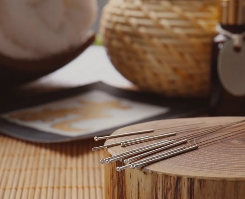 Acupuncture Johanne Mc Intyre | 858 Rue Shefford local 111, Bromont, QC J2L 1C3, Canada | Phone: (514) 222-5989