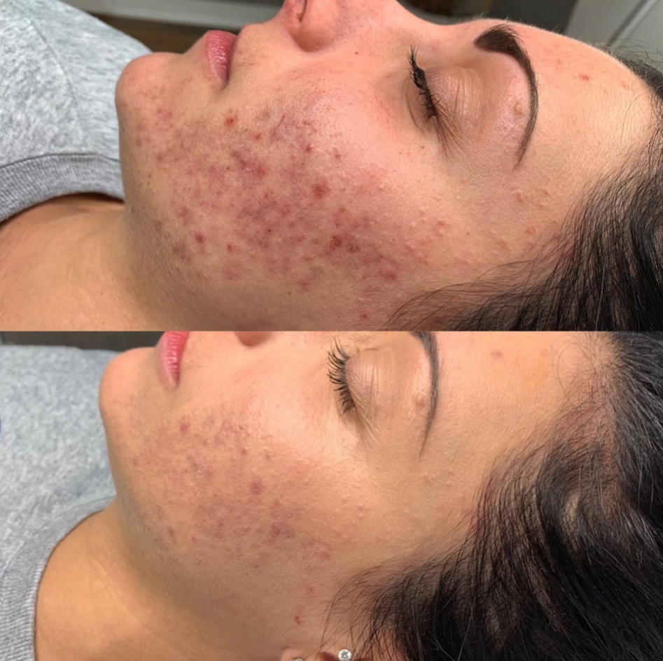 Murphy clinique médico-esthétique | 25 Rue Lapointe, Saint-Lin - Laurentides, QC J5M 2C9, Canada | Phone: (514) 833-7929