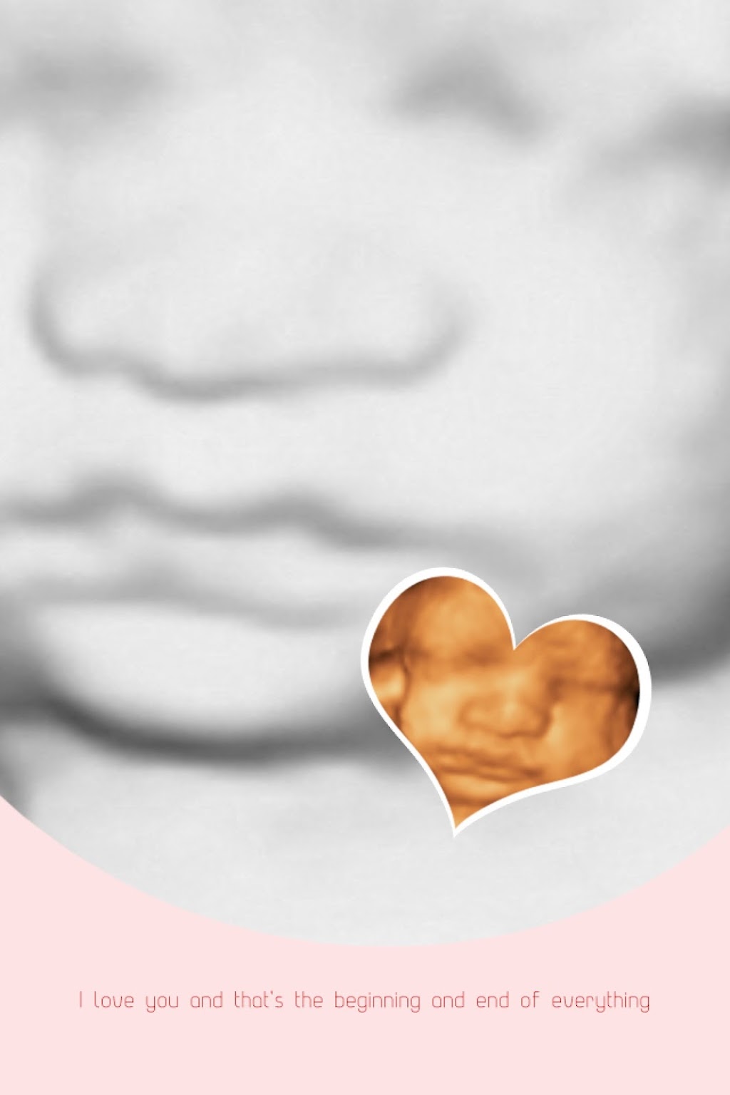 Prenatal Peek 3D4D Ultrasound | 98 Golden Boy Ln, Winnipeg, MB R3W 0L9, Canada | Phone: (204) 791-5861