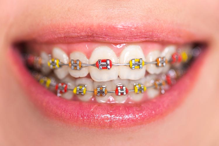 Emergency Dentist North | 12522A 132 Ave NW, Edmonton, AB T5L 3P9, Canada | Phone: (587) 400-3982