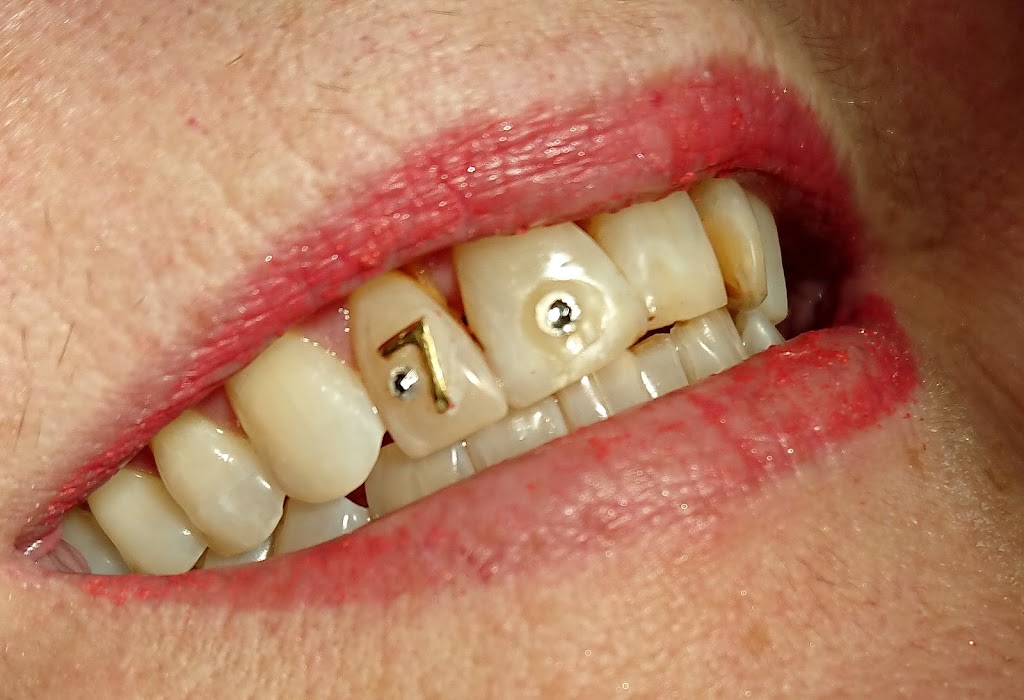 Sorriso Dental Care Clinic | dentist | 9780 Bramalea Rd Suit 308, Brampton, ON L6S 2P1, Canada | 4168226751 OR +1 416-822-6751