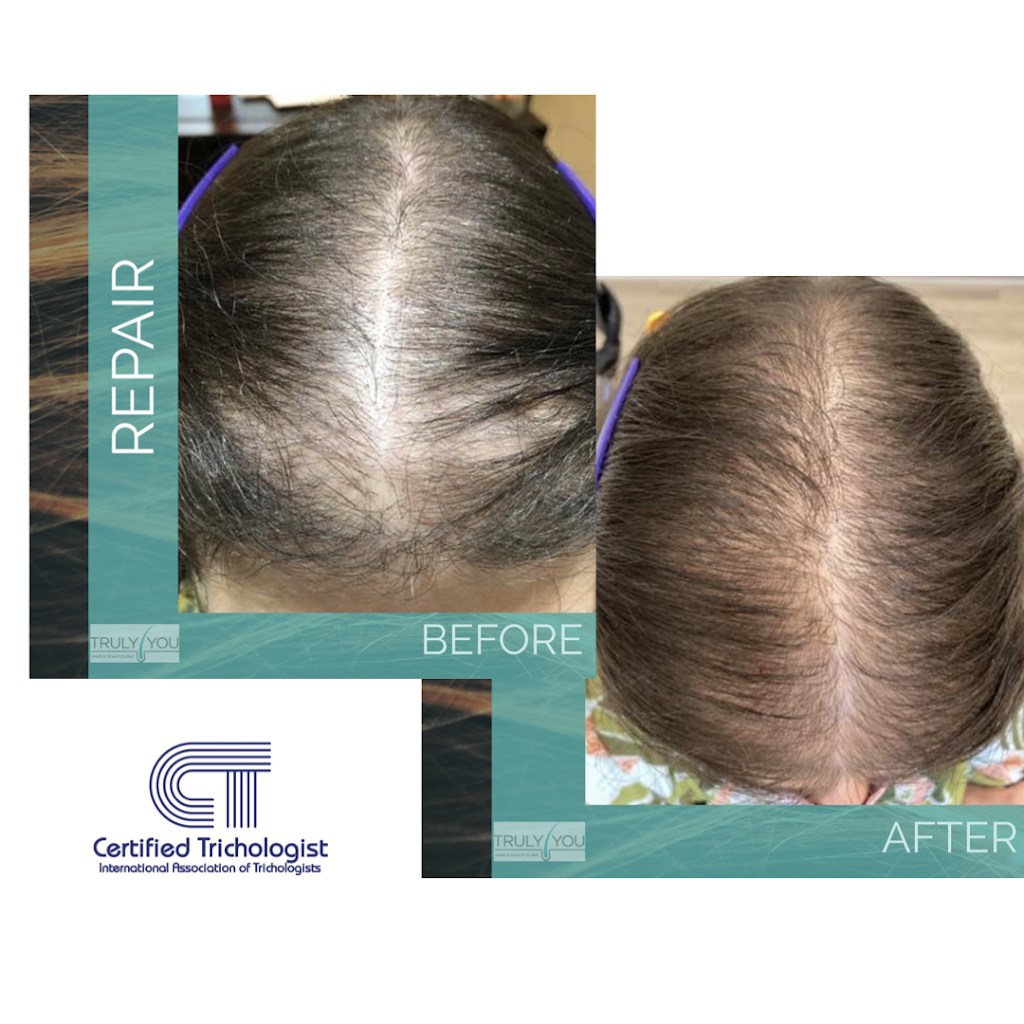 Truly You Hair and Scalp Clinic | 1225 Queensway E Unit #34, Mississauga, ON L4Y 0G4, Canada | Phone: (905) 821-1092