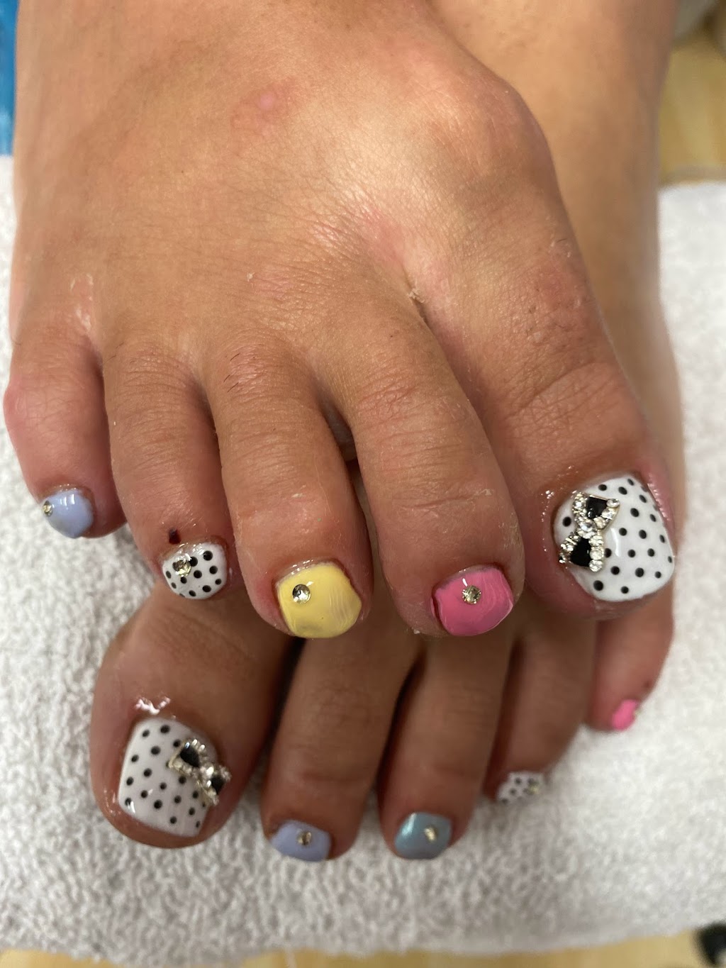 Alexandra Esthétique | 16 Westminster Ave N #205, Montreal West, QC H4W 1Y8, Canada | Phone: (514) 910-2125